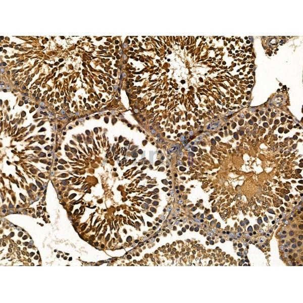LYRIC Antibody - DF13437 at 1/100 staining Rat testis tissue by IHC-P.