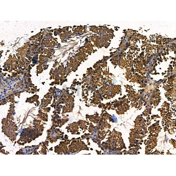 LYRIC Antibody - DF13437 at 1/100 staining Mouse testis tissue by IHC-P.