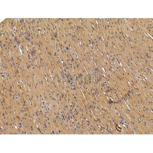 Frizzled 4 Antibody - DF13439 at 1/100 staining Rat heart tissue by IHC-P.