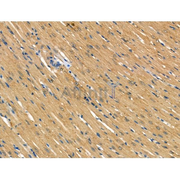 TOM1L2 Antibody - DF13443 at 1/100 staining Rat heart tissue by IHC-P.