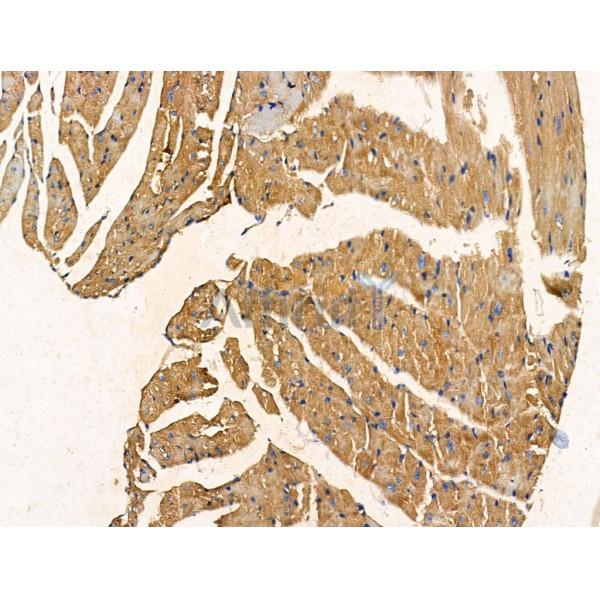 Phospho1 Antibody - DF13449 at 1/100 staining Mouse heart tissue by IHC-P.