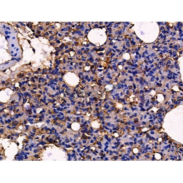 T Plastin Antibody - DF13459 at 1/100 staining Rat lung tissue by IHC-P.