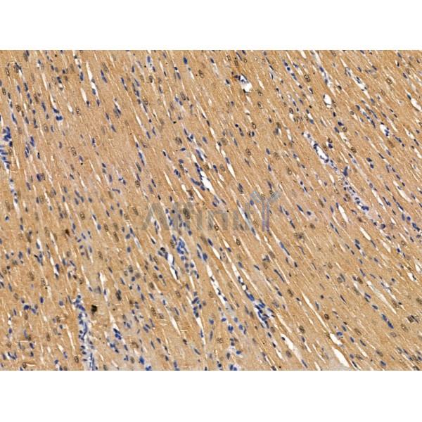 PSMD1 Antibody - DF13463 at 1/100 staining Rat heart tissue by IHC-P.