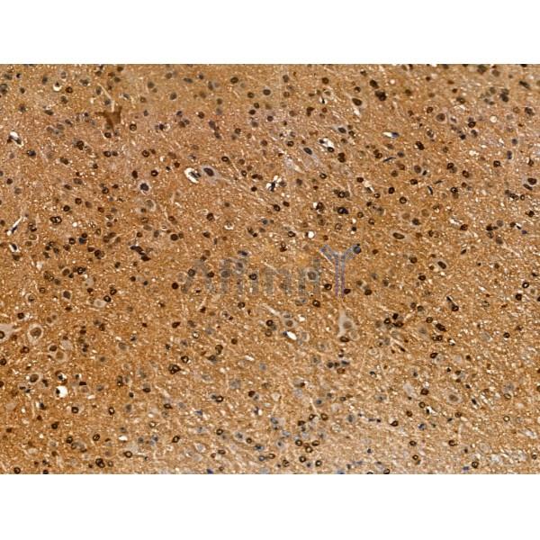 Apc7 Antibody - DF13464 at 1/100 staining Mouse brain tissue by IHC-P.