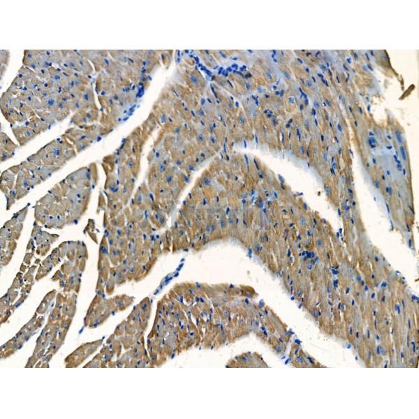 Kinesin 5A Antibody - DF13467 at 1/100 staining Mouse heart tissue by IHC-P.