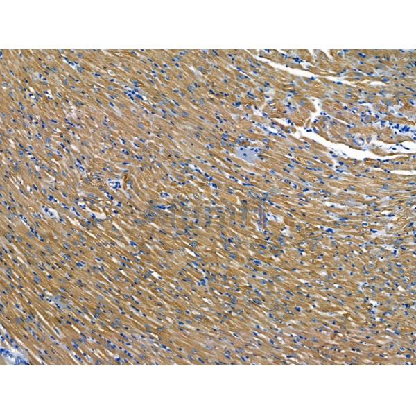 Kinesin 5A Antibody - DF13467 at 1/100 staining Rat heart tissue by IHC-P.