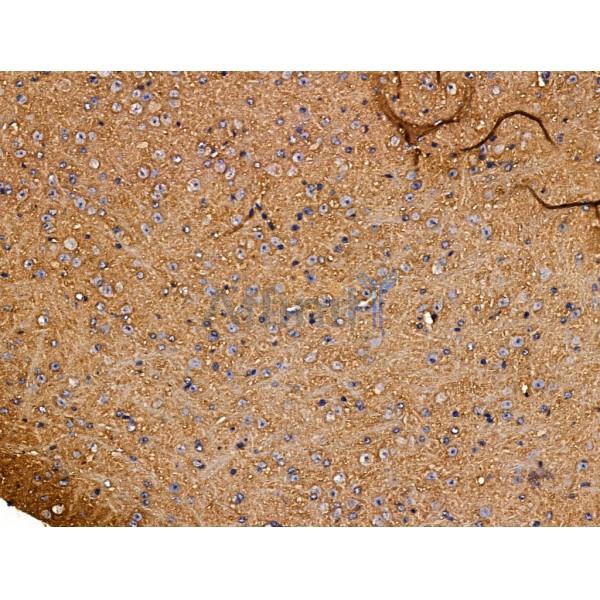 KCNK10 Antibody - DF13480 at 1/100 staining Mouse brain tissue by IHC-P.