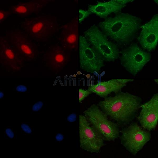 APR3 Antibody - DF2273 staining A549 cells by IF/ICC.