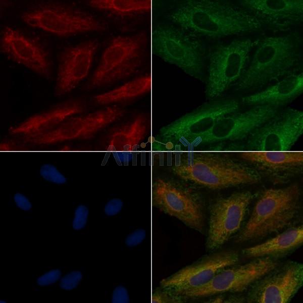Cylicin 1 Antibody - DF2330 staining A549 cells by IF/ICC.