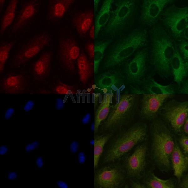 PRKCI Antibody - DF2676 staining A549 cells by IF/ICC.