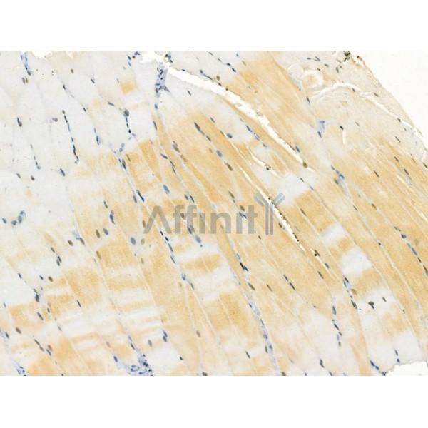 TLR8 Antibody - DF6426 at 1/100 staining Rat muscle tissue by IHC-P.