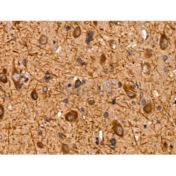 pan-AKT1/2/3 Antibody - AF0791 at 1/100 staining Rat brain tissue by IHC-P.