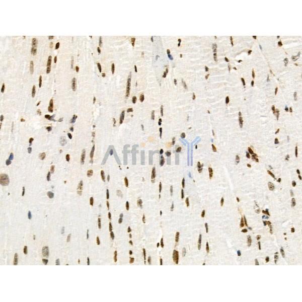 Phospho-TMS1/ASC (Ser195) Antibody - AF3515 at 1/100 staining Mouse heart tissue by IHC-P.