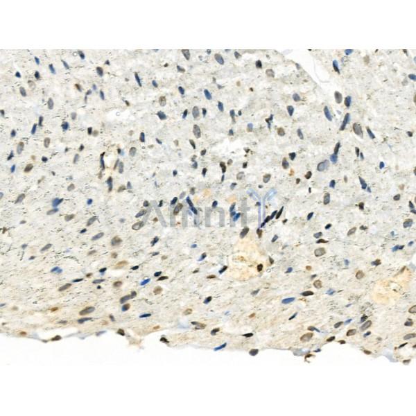 Phospho-TMS1/ASC (Ser195) Antibody - AF3515 at 1/100 staining Rat heart tissue by IHC-P.