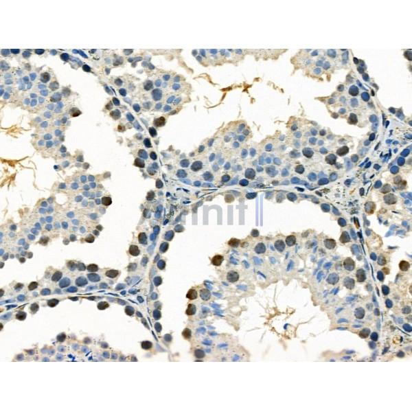 Phospho-RAD18 (Ser471) Antibody - AF3530 at 1/100 staining Mouse testis tissue by IHC-P.