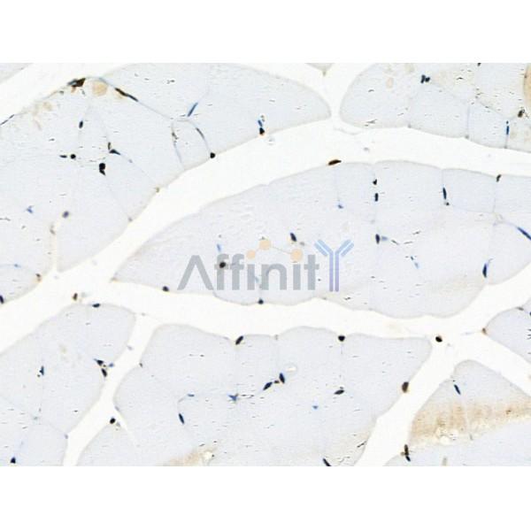 Phospho-RAD18 (Ser471) Antibody - AF3530 at 1/100 staining Mouse muscle tissue by IHC-P.