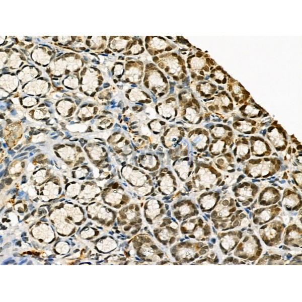 Phospho-RAD18 (Ser471) Antibody - AF3530 at 1/100 staining Rat stomach tissue by IHC-P.