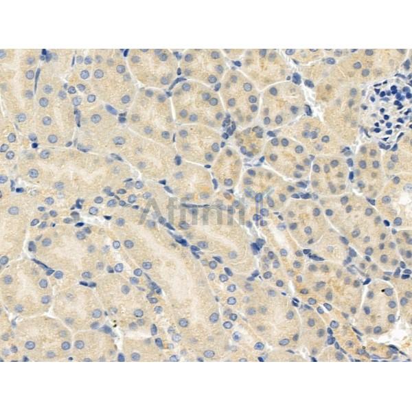 Phospho-CDC16/APC6 (Ser560) Antibody - AF3608 at 1/100 staining Mouse kidney tissue by IHC-P.