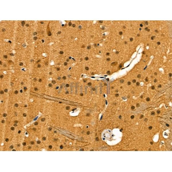 Phospho-MEF2C (Ser222) Antibody - AF3617 at 1/100 staining Mouse brain tissue by IHC-P.