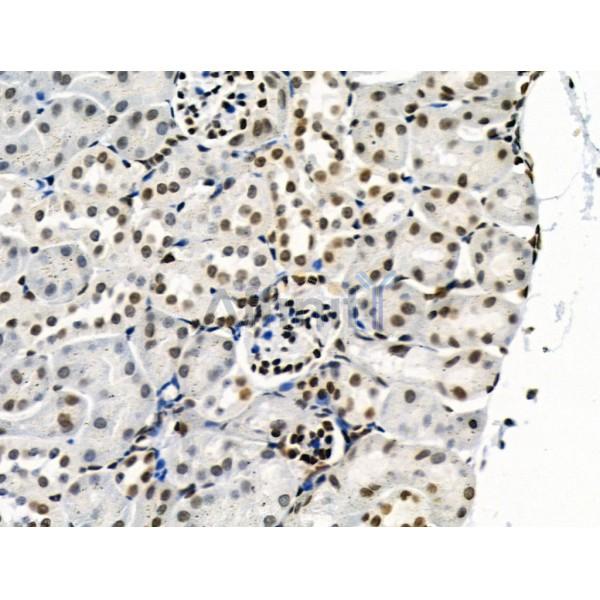 Phospho-SRPK2 (Thr492) Antibody - AF3632 at 1/100 staining Mouse kidney tissue by IHC-P.