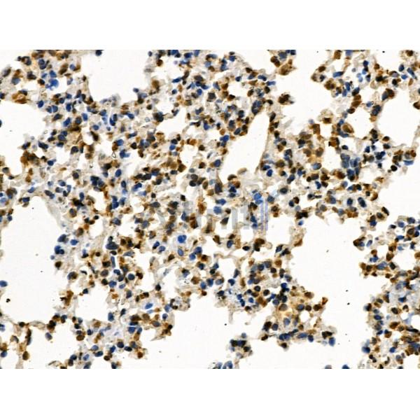 Phospho-Rab8 (Thr72) Antibody - AF3644 at 1/100 staining Mouse lung tissue by IHC-P.