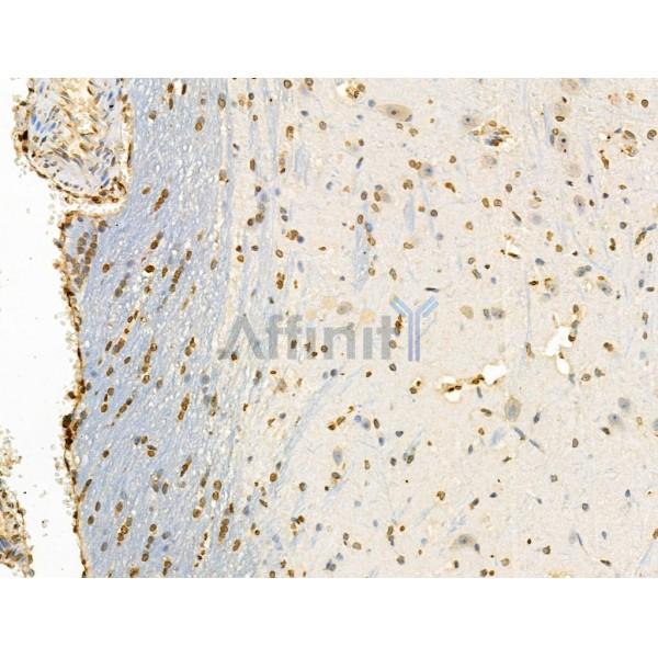 Phospho-Rab8 (Thr72) Antibody - AF3644 at 1/100 staining Rat brain tissue by IHC-P.