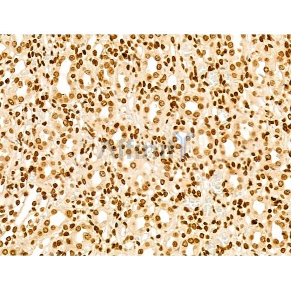 Phospho-Rab8 (Thr72) Antibody - AF3644 at 1/100 staining Rat kidney tissue by IHC-P.