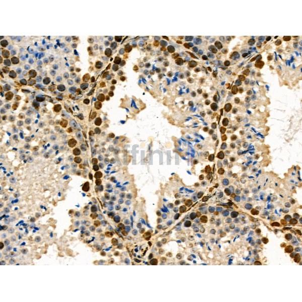 Phospho-Rab8 (Thr72) Antibody - AF3644 at 1/100 staining Mouse testis tissue by IHC-P.