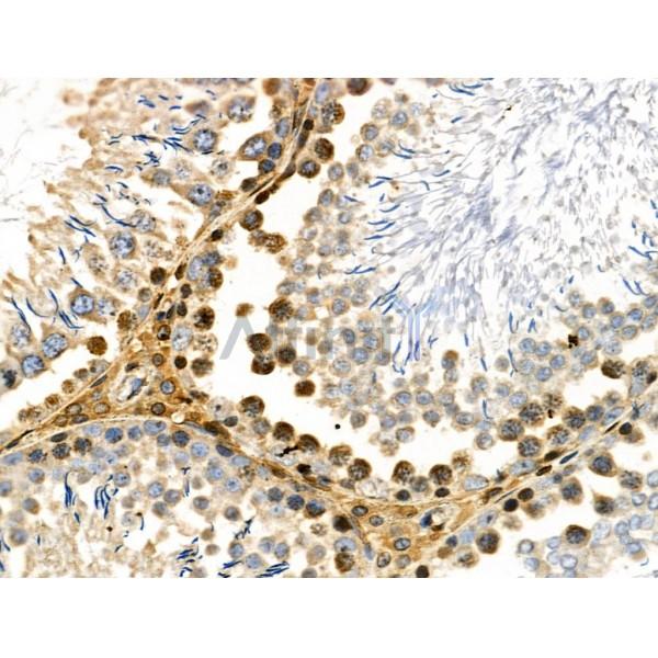 Phospho-Rab8 (Thr72) Antibody - AF3644 at 1/100 staining Rat testis tissue by IHC-P.