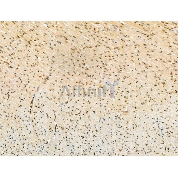 Phospho-Rab8 (Thr72) Antibody - AF3644 at 1/100 staining Rat heart tissue by IHC-P.