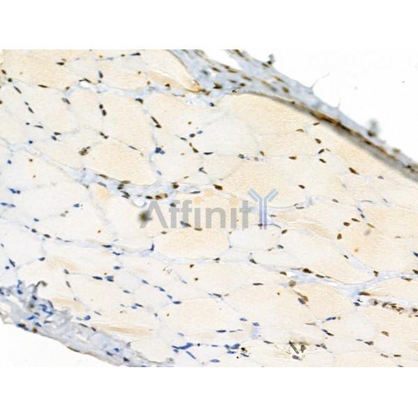 Phospho-Rab8 (Thr72) Antibody - AF3644 at 1/100 staining Rat skin tissue by IHC-P.