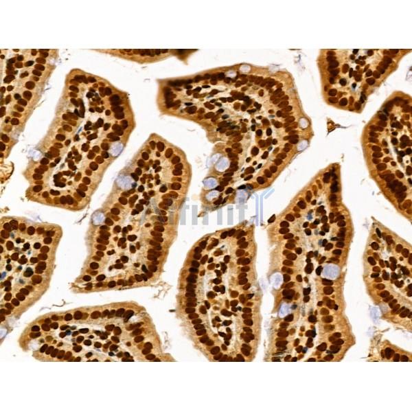 Phospho-Rab8 (Thr72) Antibody - AF3644 at 1/100 staining Mouse colorectal tissue by IHC-P.