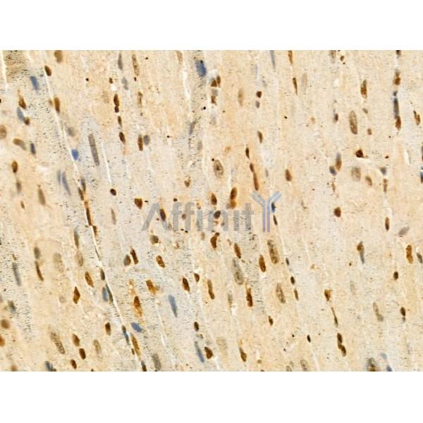 Phospho-RSK2 (Ser386) Antibody - AF3655 at 1/100 staining Mouse heart tissue by IHC-P.