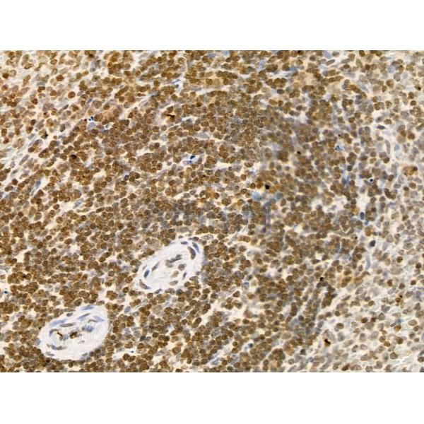 Phospho-BRG1 (Ser721) Antibody - AF3657 at 1/100 staining Rat spleen tissue by IHC-P.