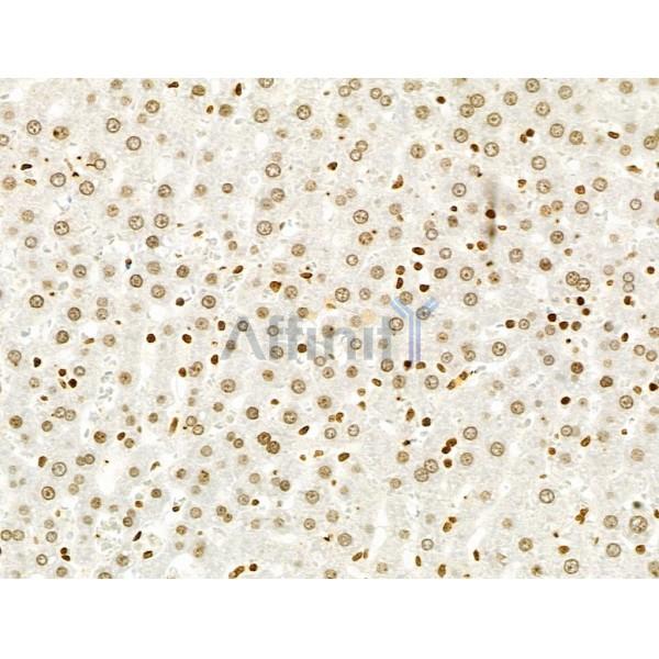 Phospho-BRG1 (Ser721) Antibody - AF3657 at 1/100 staining Rat liver tissue by IHC-P.