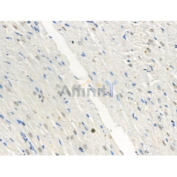 Phospho-Gli2 (Ser149) Antibody - AF3733 at 1/100 staining Rat heart tissue by IHC-P.