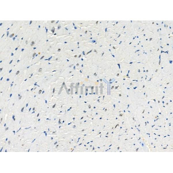 Phospho-Gli2 (Ser149) Antibody - AF3733 at 1/100 staining Mouse heart tissue by IHC-P.