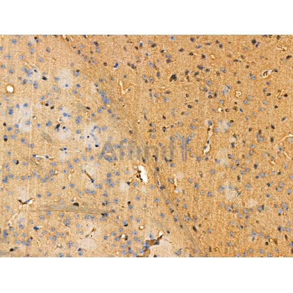 Phospho-Tau (Ser202/Ser519) Antibody - AF3947 at 1/100 staining Mouse brain tissue by IHC-P.