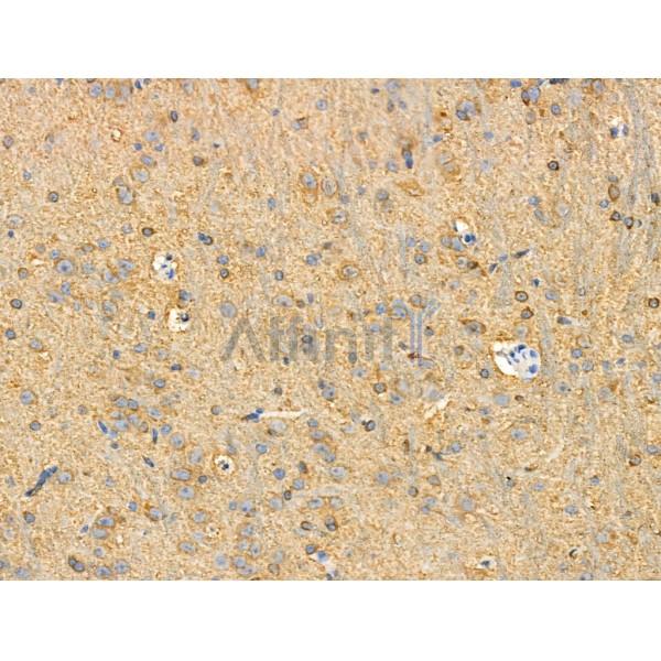 Phospho-Tau (Ser202/Ser519) Antibody - AF3947 at 1/100 staining Rat brain tissue by IHC-P.