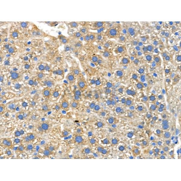 Phospho-PEA15 (Ser104) Antibody - AF3963 at 1/100 staining Mouse liver tissue by IHC-P.