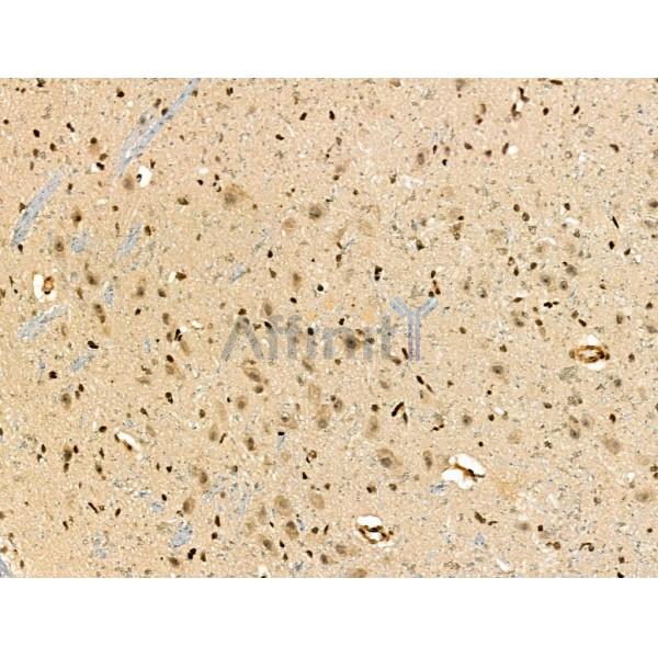 Phospho-TIS11B (Ser92) Antibody - AF3965 at 1/100 staining Rat brain tissue by IHC-P.