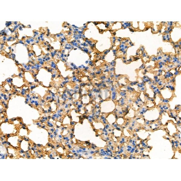 Phospho-CD32 (Tyr288) Antibody - AF4348 at 1/100 staining Rat heart tissue by IHC-P.