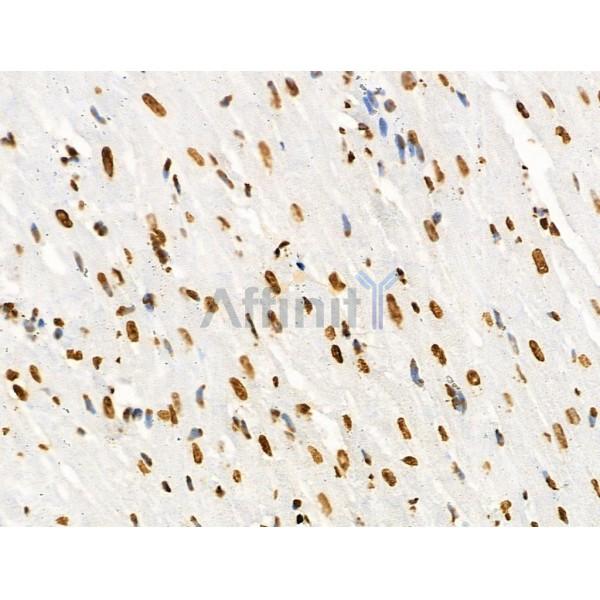 Acetyl-Histone H2A (Lys5) Antibody - AF4354 at 1/100 staining Rat heart tissue by IHC-P.