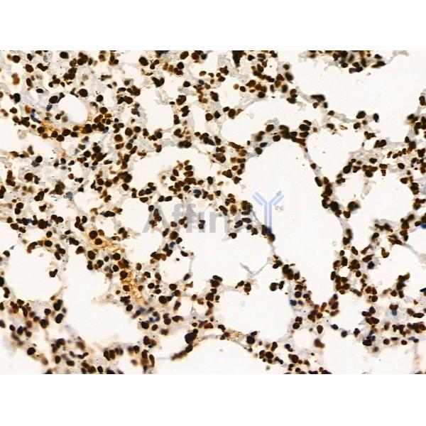 Acetyl-Histone H2A (Lys5) Antibody - AF4354 at 1/100 staining Mouse lung tissue by IHC-P.