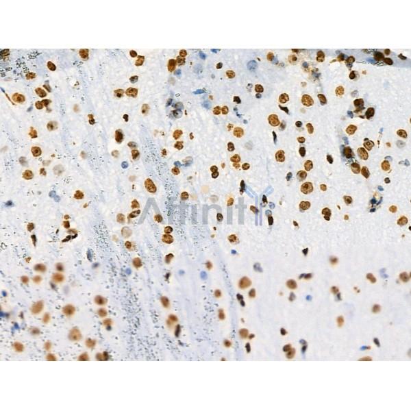 Acetyl-Histone H2A (Lys5) Antibody - AF4354 at 1/100 staining Mouse brain tissue by IHC-P.