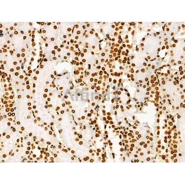 Acetyl-Histone H2A (Lys5) Antibody - AF4354 at 1/100 staining Rat kidney tissue by IHC-P.