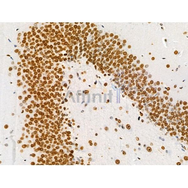 Acetyl-Histone H2A (Lys5) Antibody - AF4354 at 1/100 staining Rat brain tissue by IHC-P.