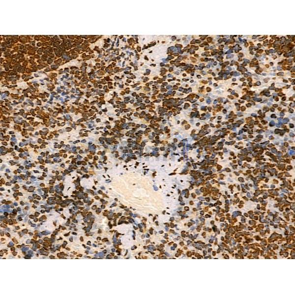Acetyl-Histone H2A (Lys5) Antibody - AF4354 at 1/100 staining Rat spleen tissue by IHC-P.