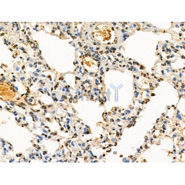 Acetyl-Histone H4 (Lys91) Antibody - AF4357 at 1/100 staining Mouse lung tissue by IHC-P.