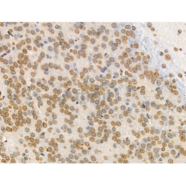 Acetyl-Histone H4 (Lys91) Antibody - AF4357 at 1/100 staining Rat brain tissue by IHC-P.